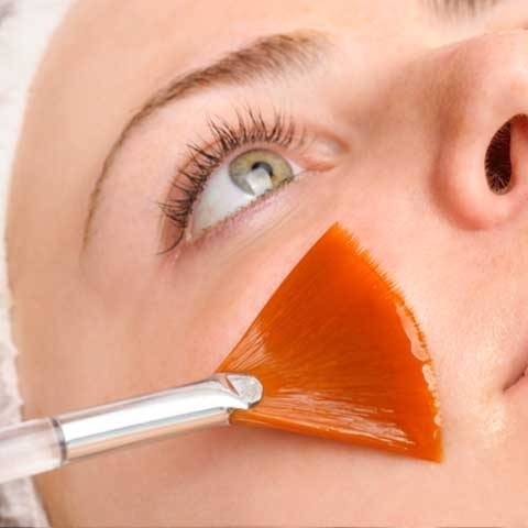Peeling I  - 1 Mes
