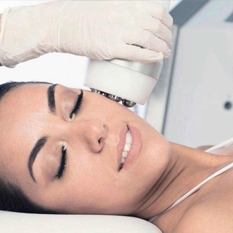 CRIO-Radiofrecuencia Facial 1 zona