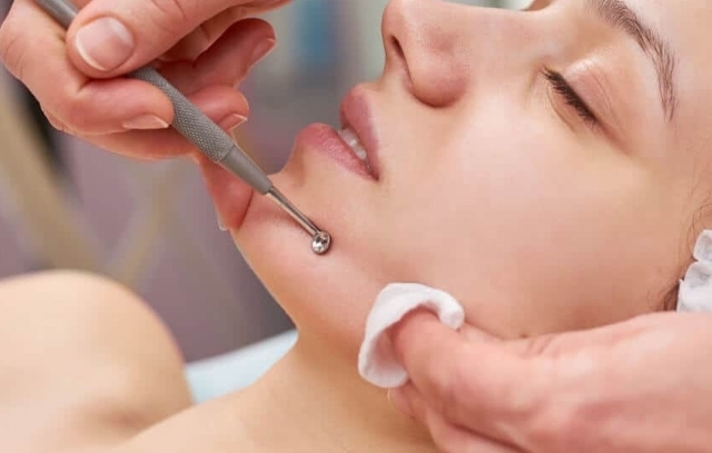 Limpieza Facial Extracciones